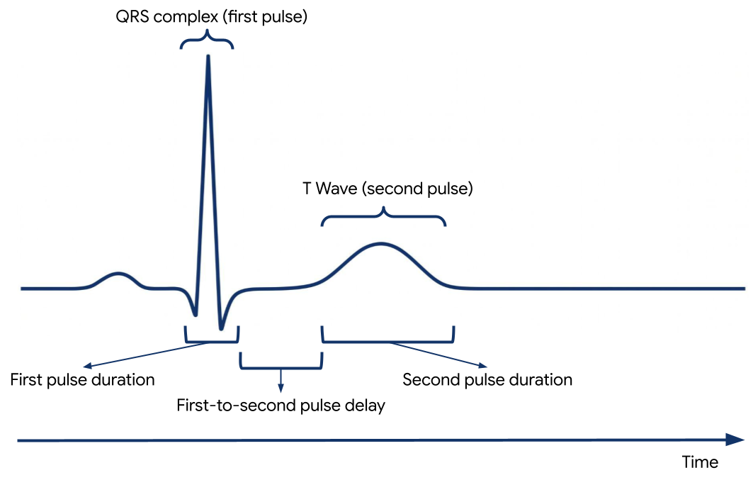 Plot of an ECG segment and its characteristic waveforms